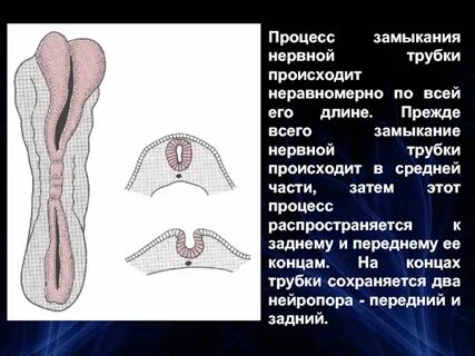 Органы из нервной трубки