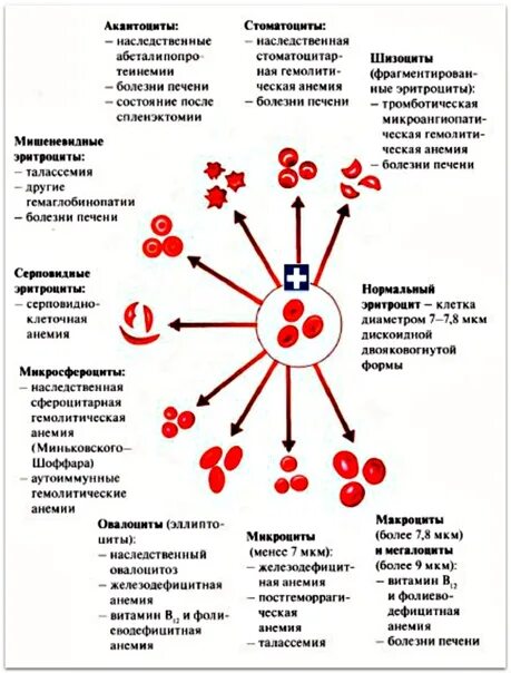 Патологические формы эритроцитов. Основные патологические формы эритроцитов. патологические формы эритроцитов при анемиях. талассемия показатели крови эритроциты. форма эритроцитов при талассемии.