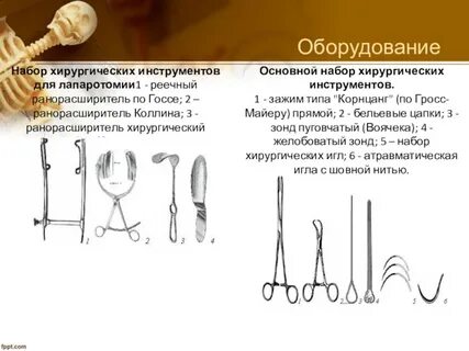 Набор для аппендэктомии