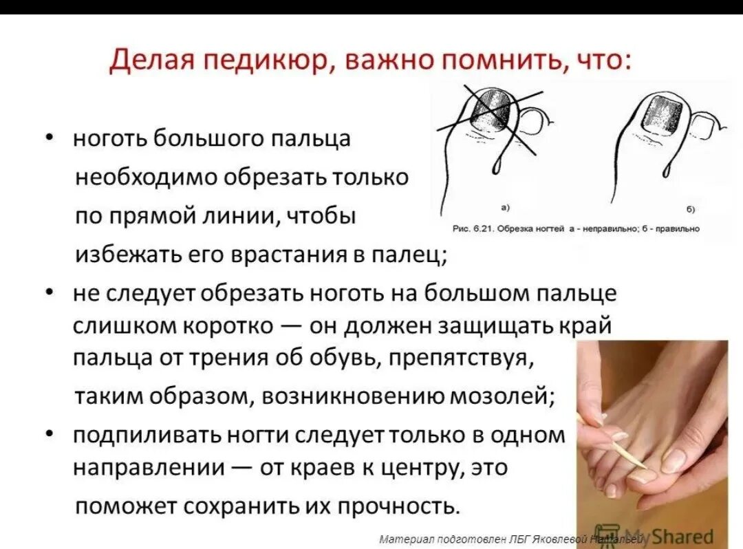 Катрравильно стритчь ногти на ногах. Как правильно постричь ногти на ногах. Приемы обрезания ногтей на руках. Как правильно стричь ногти. Как правильно подстригать ногти на руках.