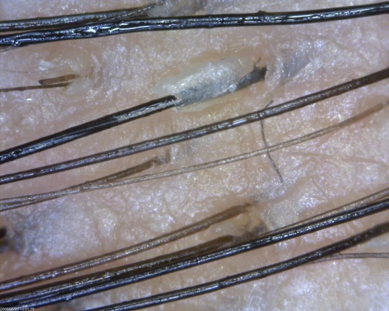 Луковица волоса под микроскопом. Волосяная луковица под микроскопом. Корень волоса под микроскопом.