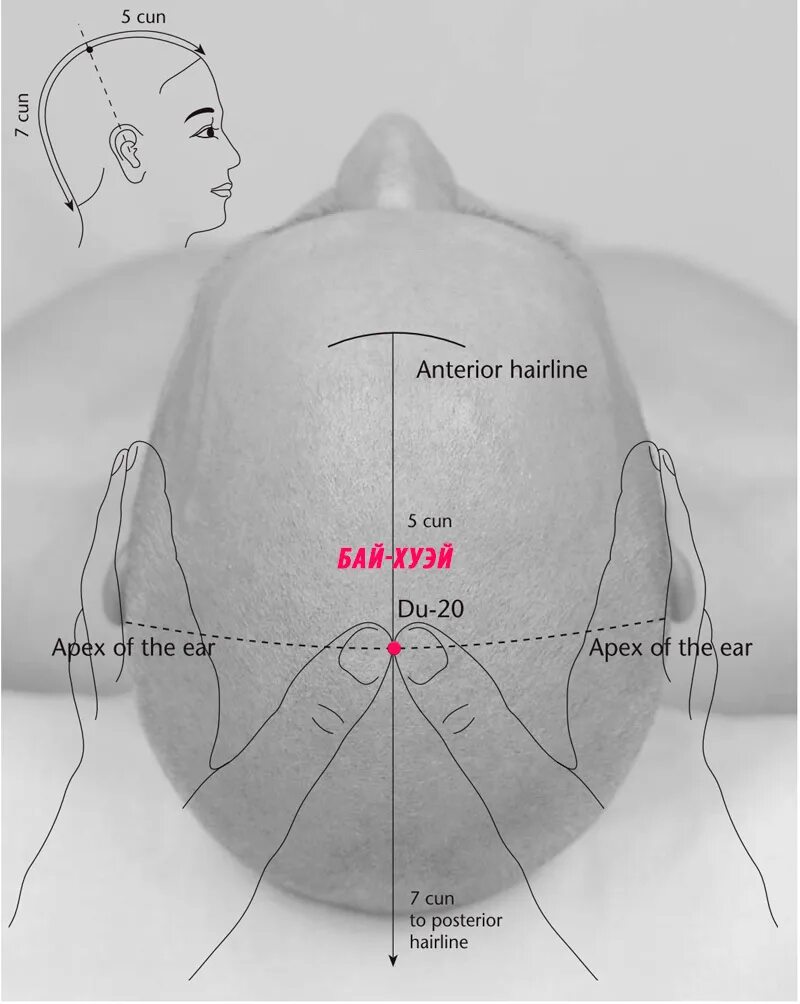 Точка 20 на телефон. Акупунктура VG 20 бай Хуэй. Vg20 точка акупунктуры. Акупунктурная точка vg20 бай-Хуэй. Точка бай Хуэй макушка.