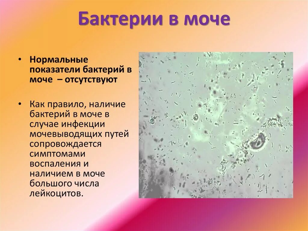 Бактерии в моче. Микроорганизмы в моче. Бактерии в моче микроскопия. Бактерии в моче у женщин причины. Бактерии и слизь в моче у женщин