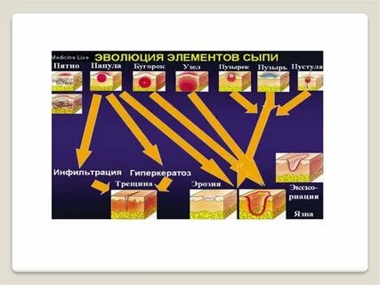 Первичные элементы поражения