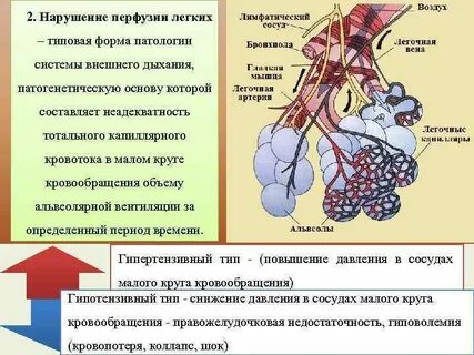 Нарушения легочного кровообращения
