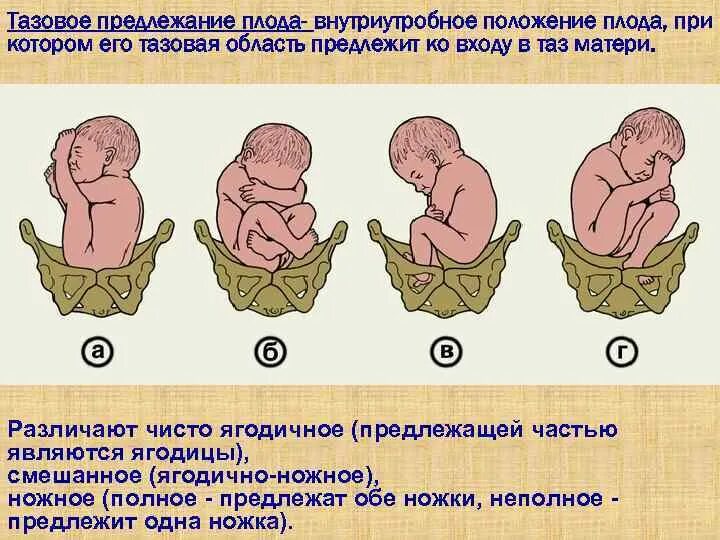 Предлежание 1 позиция. Продольное положение ягодичное предлежание. Продольно тазовое положение плода. Предлежание головное продольное 20 недель. Положение плода продольное предлежит таз плода.