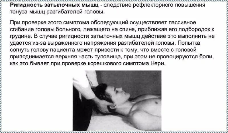 Шейная ригидность. Ригидность затылочных мышц 2пп. ригидность шейных мышц неврология. симптомы ригидности затылочных мышц шеи. симптом ригидности затылочных мышц.
