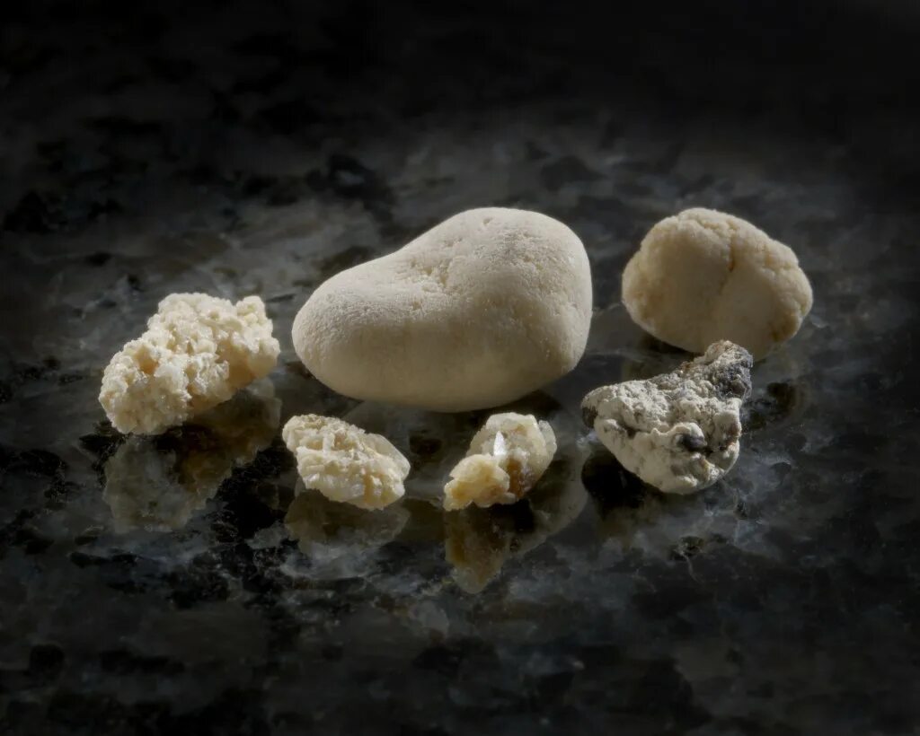 Камень в почках 2 мм. Мочекаменная болезнь цистиновые камни. Ураты камни. Фосфатные оксалатные уратные камни.