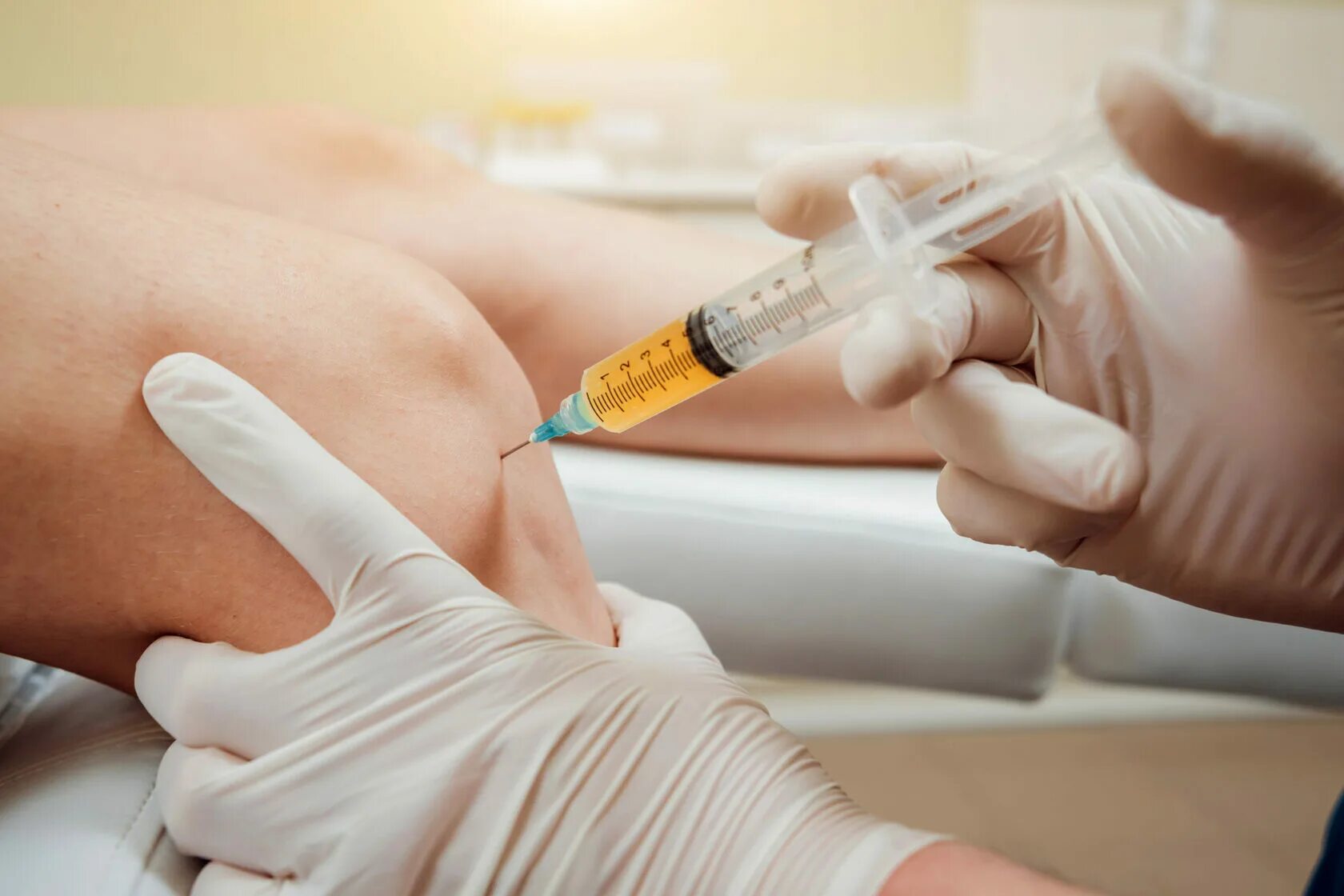 Плазма в сустав. Prp-терапия плазмотерапия. prp терапия platelet rich plasma. плазмотерапия суставов (prp-терапия, плазмолифтинг). плазма обогащенная тромбоцитами prp.