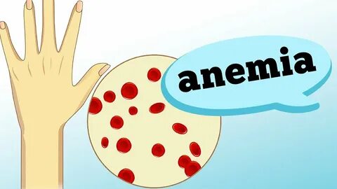Аня анемия