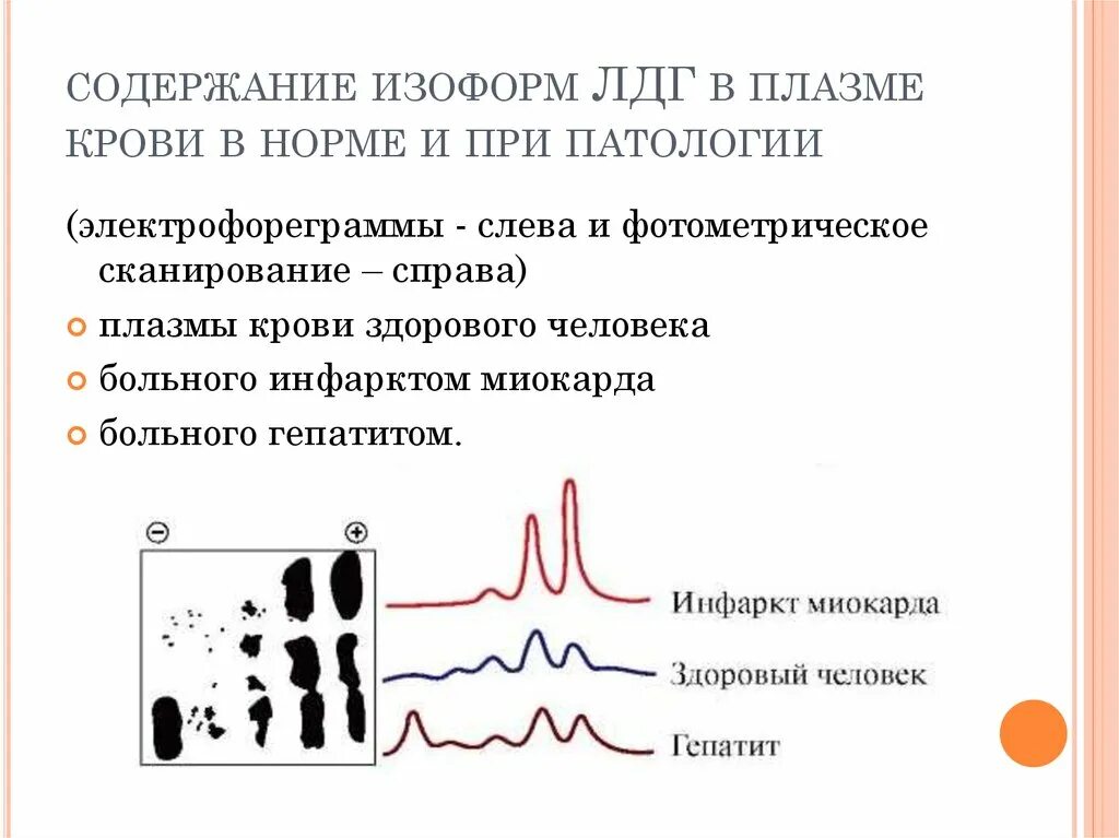 Сыворотка лдг. Электрофореграммы изоферментов лдг. электрофореграммы при патологии.