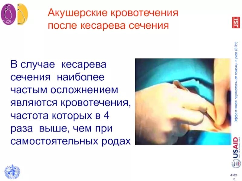 Как выглядят выделения после кесарева Diagnosis and treatment of uterine adhesions Vinmec