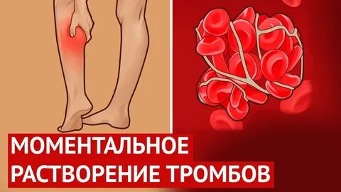 Лекарства рассасывающие тромбы