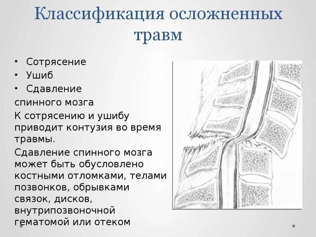 Сотрясение позвоночника. Классификация травм спинного мозга. Классификация травм позвоночника и спинного мозга. Сотрясение спинного мозга симптомы. Классификация спинальных травм.