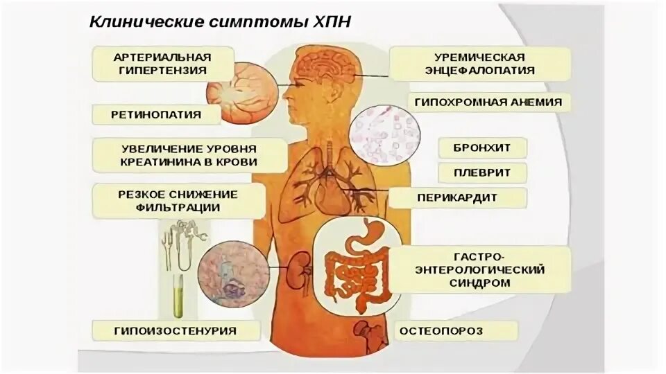 Почки выполняют функцию. Предупреждение заболеваний почек. Строение функции почек органы функции. Причины нарушения функции почек. Азота выделительная функция почек.