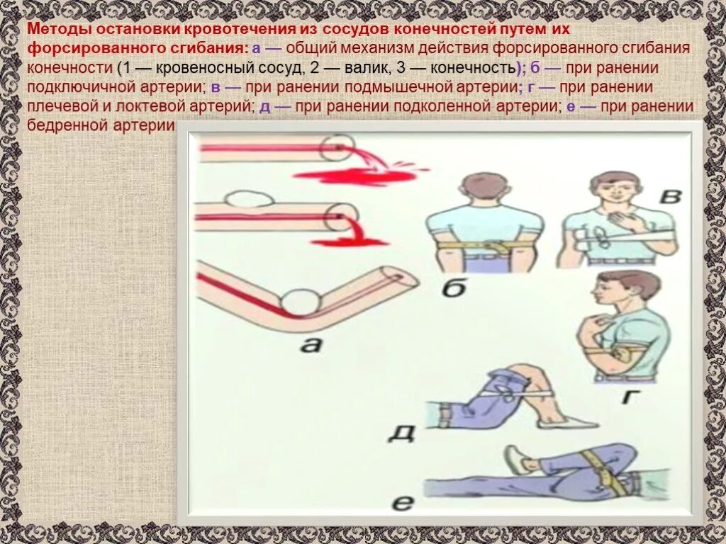 Первая помощь при кровотечении обж 8 класс