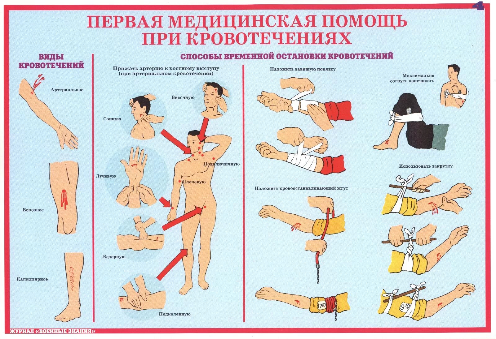 Действия при сильном кровотечении. Оказание 1 медицинской помощи при кровотечении. Памятка по оказанию первой медицинской помощи при кровотечении. Оказание 1 мед помощи при кровотечении. Оказание первой помощи при артериальном и венозном кровотечении.