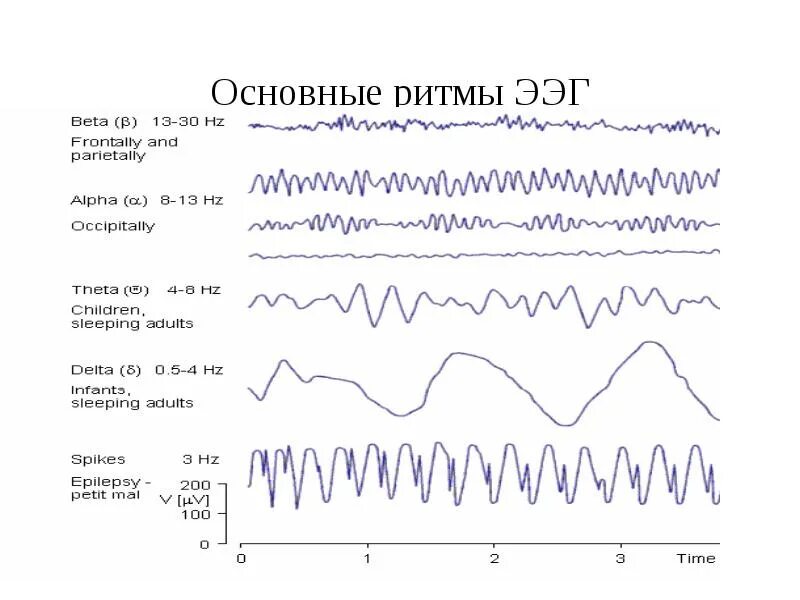 Показатели ээг. Норма Альфа ритма головного мозга при ЭЭГ. Волны на ЭЭГ расшифровка. ЭЭГ головного мозга ритм Альфа ритм норма. Расшифровка показателей электроэнцефалограммы ЭЭГ головного мозга.