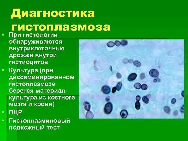 Гистоплазмоз это. Гистоплазмоз вызывается дрожжеподобным грибком.. диссеминированный гистоплазмоз. гистоплазмоз материал для исследования.