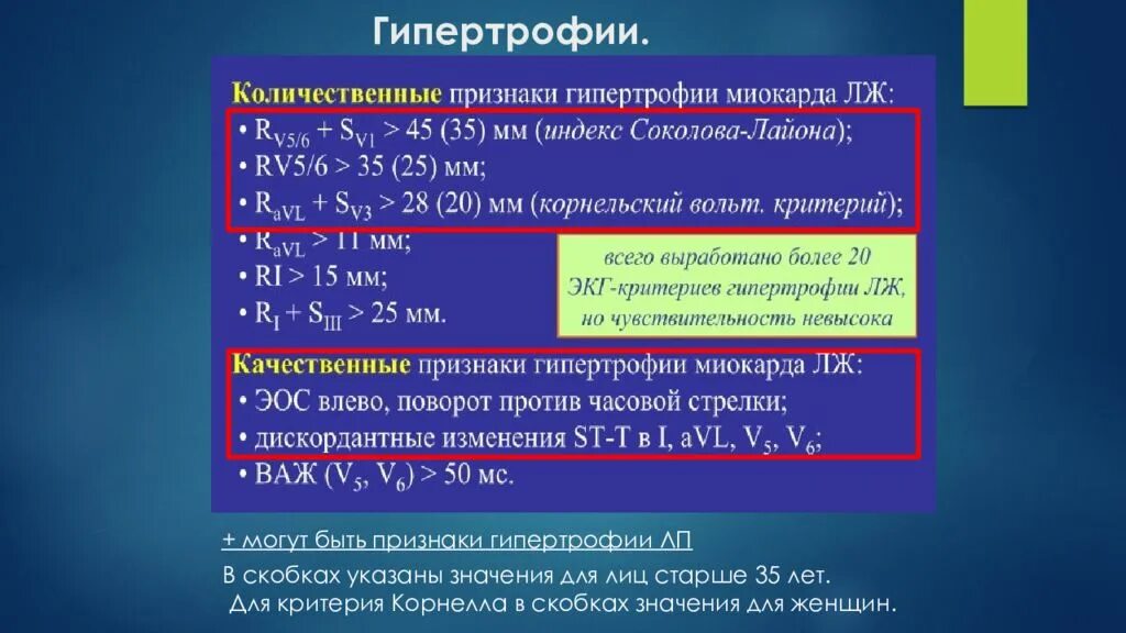 Гипертрофия миокарда левого желудочка на экг. Критерии гипертрофии. Корнельский критерий гипертрофии левого желудочка. Признаки гипертрофии лж на экг. Критерии гипертрофии левого желудочка на экг.
