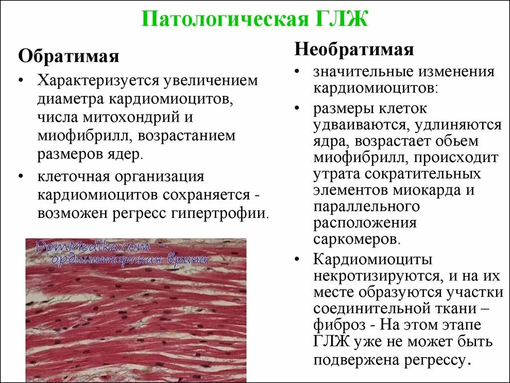 Гипертрофия миокарда лж что это. Гипертрофия кардиомиоцитов. Гипертрофия кардиомиоцитов гистология. Миофибриллы кардиомиоцитов. Контрактурные изменения кардиомиоцитов.