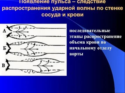 Технику распространения