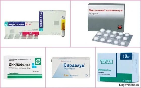 Артроз лекарства и препараты. Лекарство для остеоартроза. таблетки для остеоартроза. от остеоартроз лекарства на к. таблетки от остеоартроза суставов.