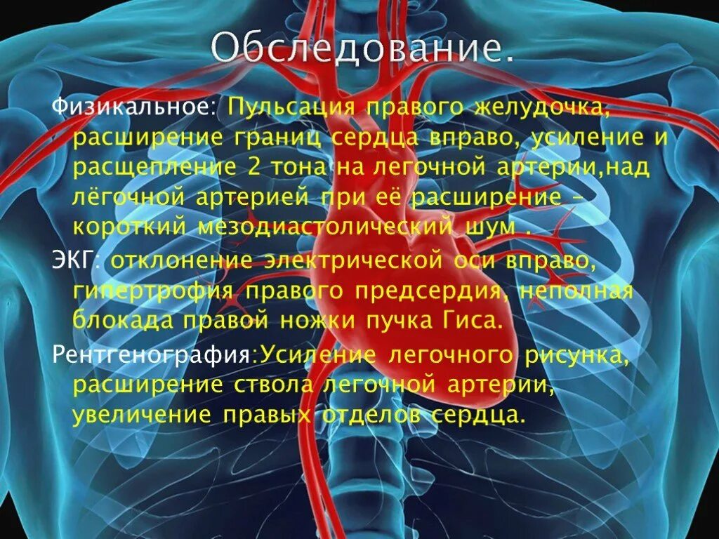 Границы сердца при врожденных пороках сердца расширены. Физикальное исследование сердца. Пульсация правого желудочка.