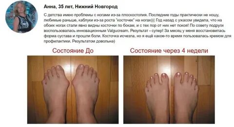 Восстановление после вальгусной