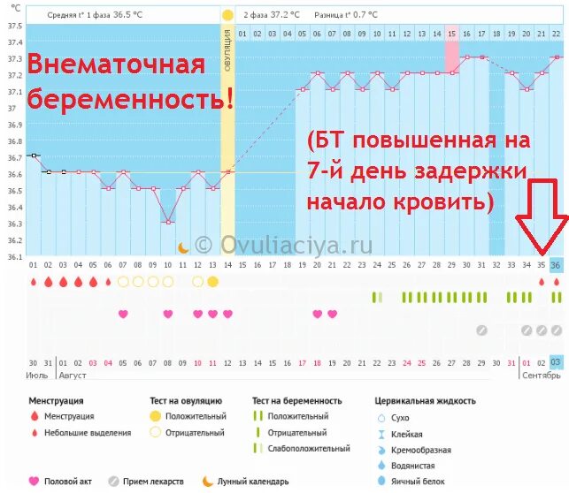 Температура третий триместр. Базальная температура на 20 день цикла при беременности. График базальной температуры при беременности на ранних. Беременные графики базальной температуры. Графики БТ при беременности.