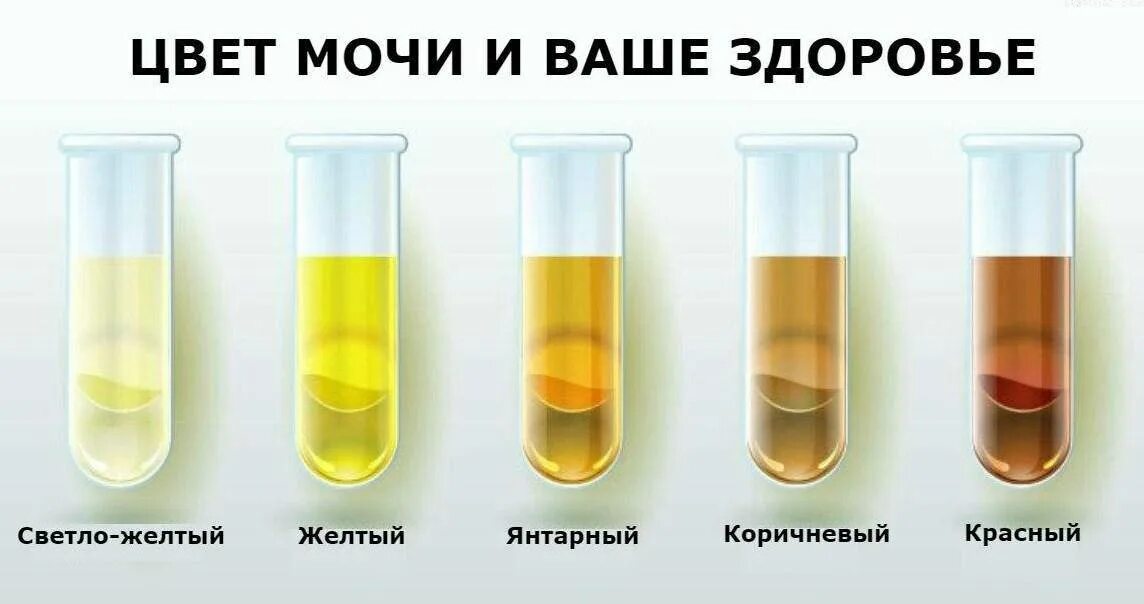 Почему моча оранжевая у женщин