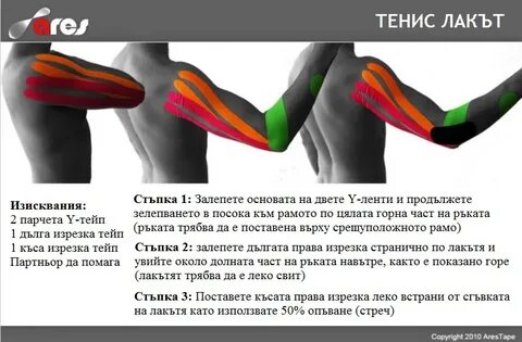 Схема тейпирования локтевого сустава