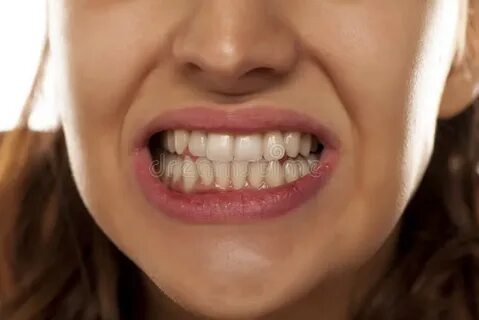 Bare teeth