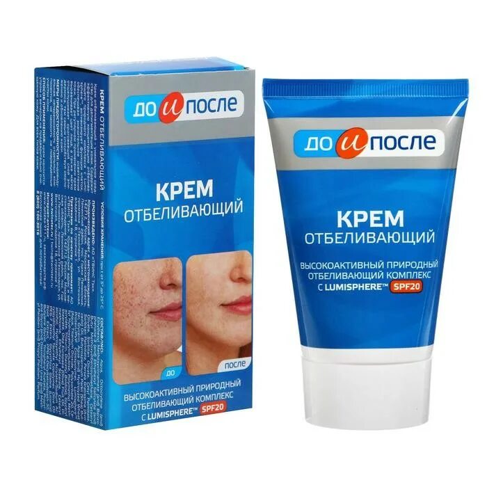 Отбеливающий крем биоква. Крем miracle cream корейский. Крем антикупероз витекс. Хороший отбеливающий крем отзывы. Крем мужской для лица от пигментных пятен.