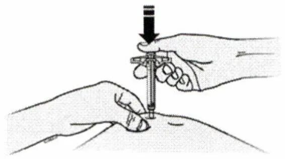 Плавно снять. Пролиа шприц. ИРИНЭКС шприц. ИРИНЭКС подкожная инъекция. Пролиа куда колоть.