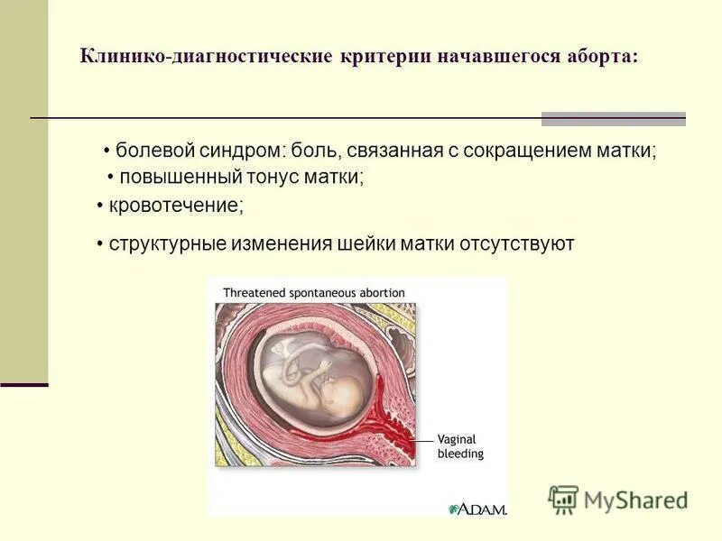 Гипертонус Матки Можно Заниматься Сексом