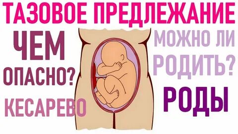 Плод во время родов