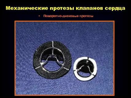 После протезирования клапана