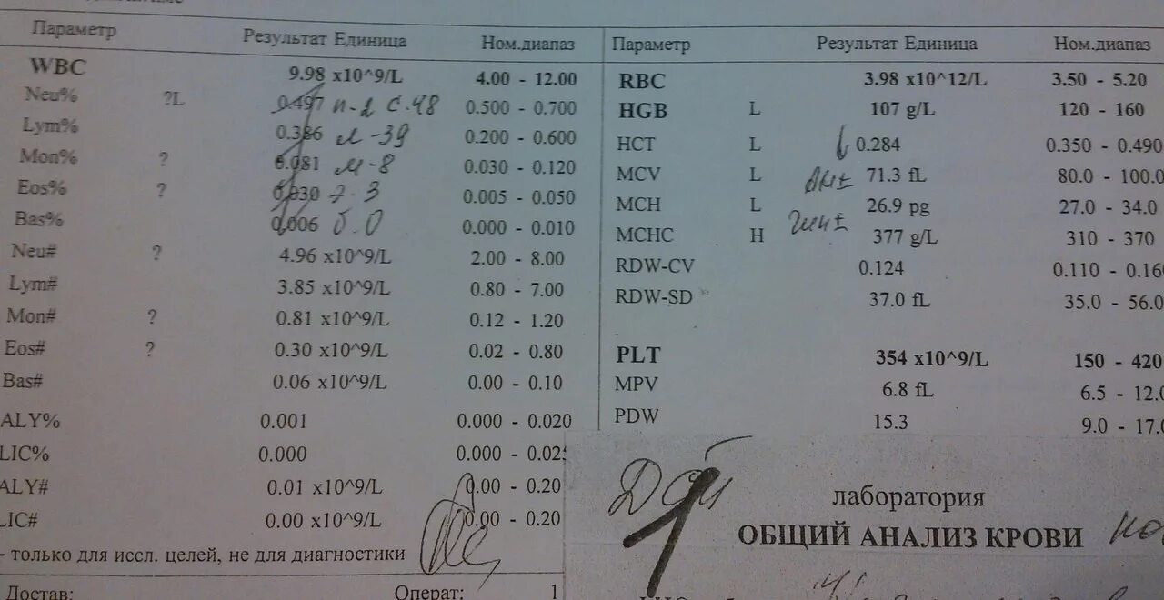 Анализ мочи расшифровка у детей. Общий анализ мочи расшифровка у детей. Общий анализ мочи у детей норма таблица. Нормы мочи общий анализ у взрослого.