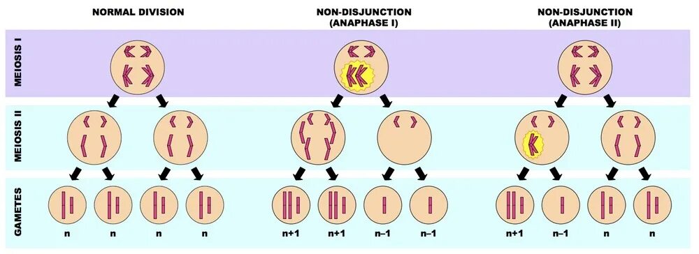 Случайное сочетание негомологичных хромосом в мейозе. Синдром Дауна нерасхождение в мейозе. Синдром Дауна нарушение деления мейоз. Нерасхождение хромосом при синдроме Дауна. Нарушение расхождения хромосом в мейозе.