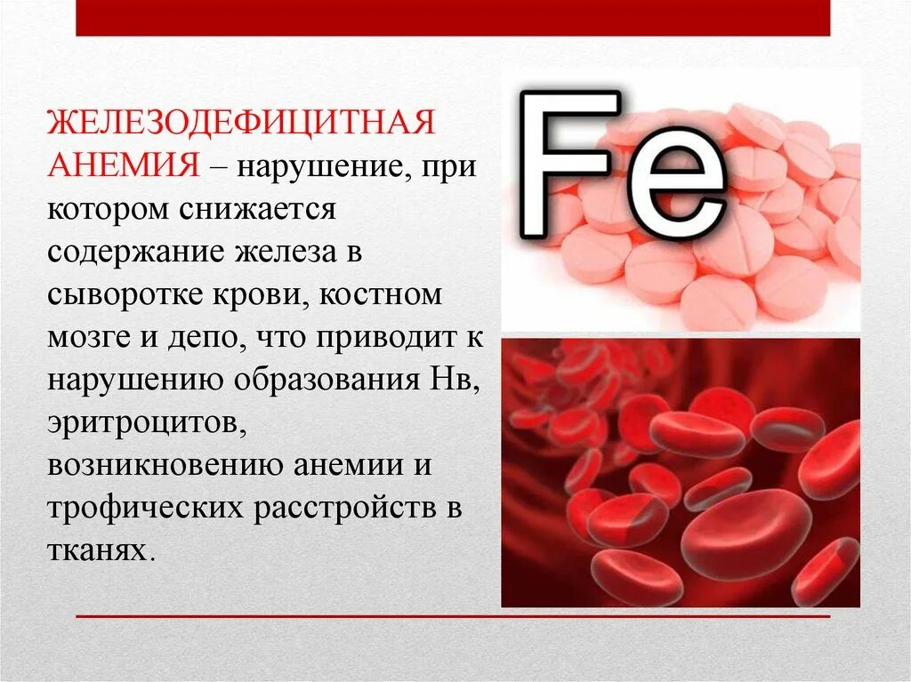 Признаки дефицитной анемии. Железнодефецитная Анимия. Железодефицитная анемия проявления. Железодефицитная анемия (жда). Железо крови при железодефицитной анемии.