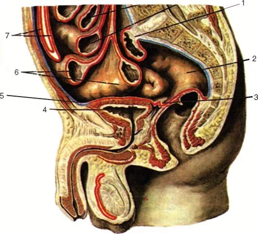 брюшинный отдел малого таза. ход брюшины в малом тазу. ход брюшины в женском тазу. сагиттальный ход брюшины. прямокишечно маточное углубление топография.
