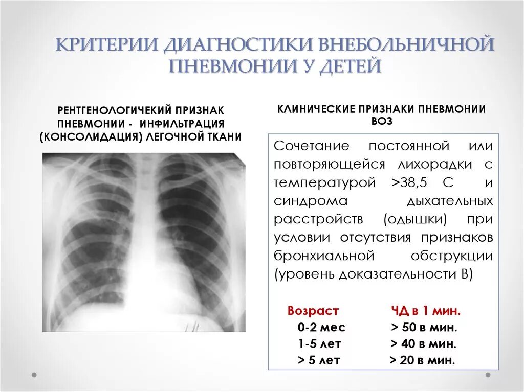 Симптомы пневмонии. Пневмония у ребенка 3 года рентген. Внебольничная двусторонняя пневмония диагноз. Диагностика внебольничной пневмонии у детей. Диагностические критерии пневмонии у детей.