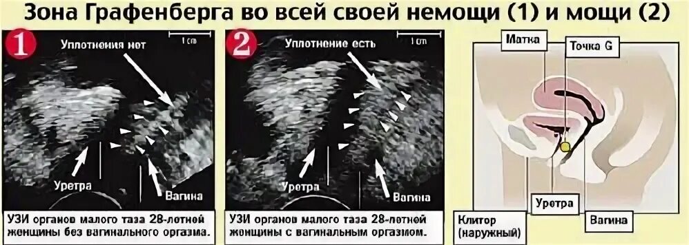 Где находится точка g у женщин. Зона графенберга. пятно графенберга. зона графенберга для женщин. точка графенберга у женщин.