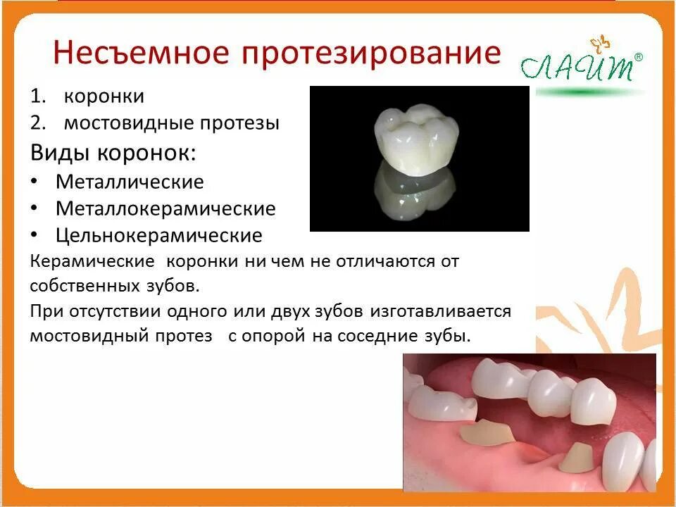 Клинические рекомендации протезирование