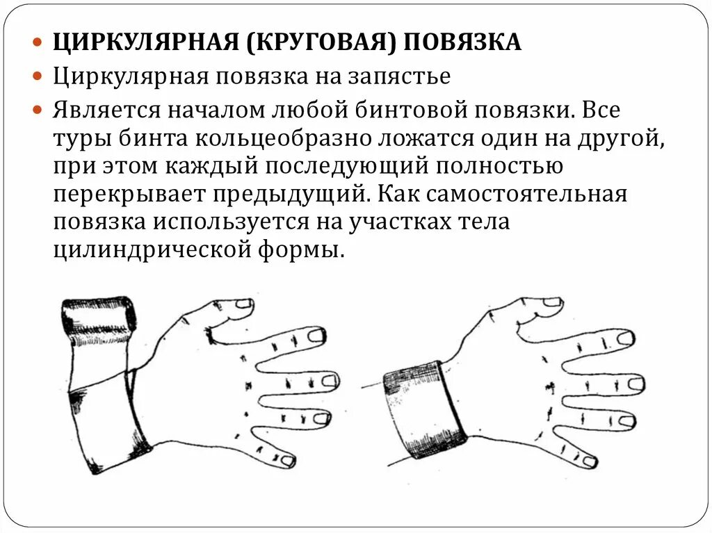 Бинтовая повязка алгоритм. Практическая работа наложение повязок. Правила наложения бинтовых повязок. Требования к бинтовой повязке. Какая повязка является началом любой мягкой бинтовой повязки?.