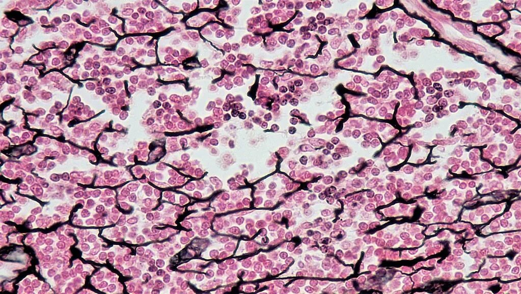 Diagram of Reticular Connective Tissue Quizlet