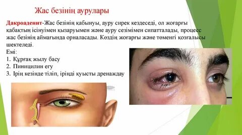 Тамаша блять және сору