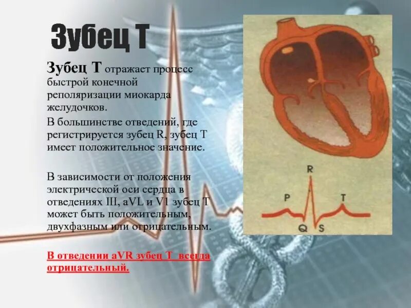 Снижение процессов реполяризации. Зубец реполяризации. зубец т отражает процессы. зубец т в норме. нарушение процессов реполяризации.