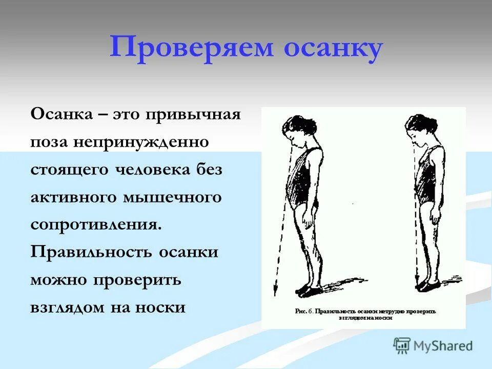 Нарушение осанки круглая спина. Нарушения осанки сутоловатости. Виды неправильной осанки. Упражнения для осанки. Правильное расположение осанки.